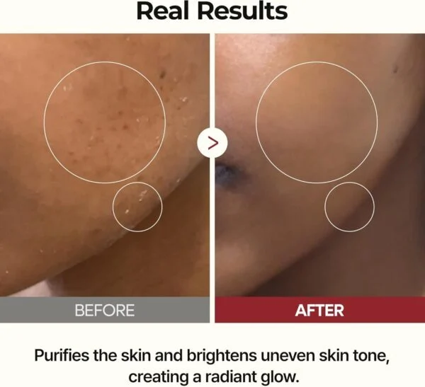 تونر تخصصی روشنکننده و آبرسان دکتر ملاکسین مدل Peel Shot Glow Rice