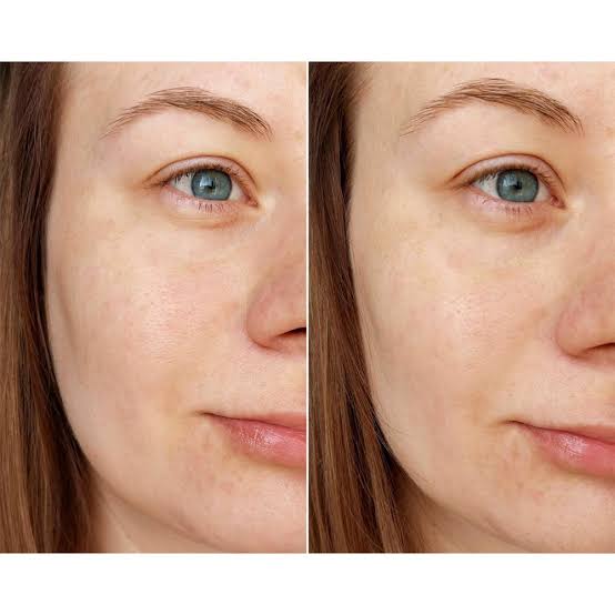 ژل شستشوی روشن کننده کپسولی اسکین 1004 مدل Centella Tone Brightening - تصویر 3