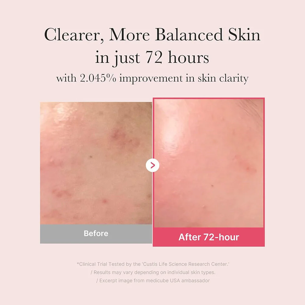 سرم ضد لک TXA و نیاسین آمید مدی کیوب Medicube TXA+Niacinamide 15% Glow Facial Serum - تصویر 4