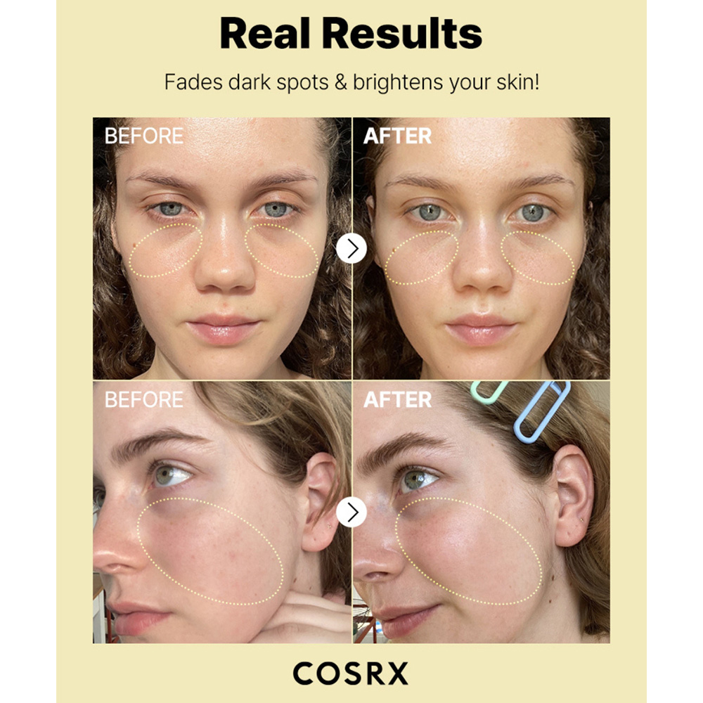 سرم ویتامین C 23 درصد کوزارکس مدل COSRX The Vitamin C 23 Serum روشنکننده و ضدلک قوی - تصویر 3
